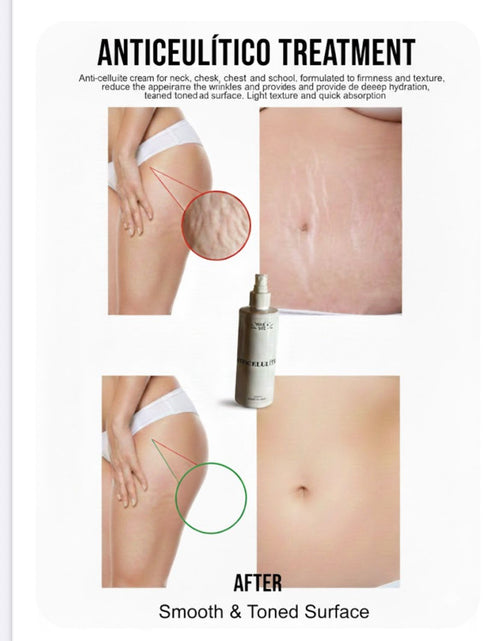 HOLA SOL Anti-Cellulite Spray – 200ml